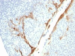 Cytokeratin 16 Antibody (rKRT16/1714) - Azide and BSA Free, Novus Biologicals